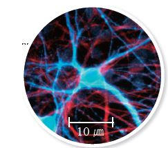 모세혈관 이미지(10 um) - 정확한 이미지로 수정
