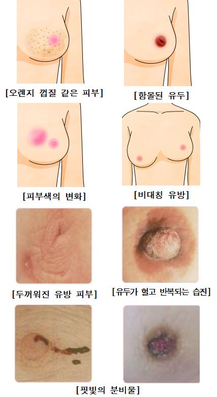 (주)와이비엠 보건 193쪽 수정내용 이미지
